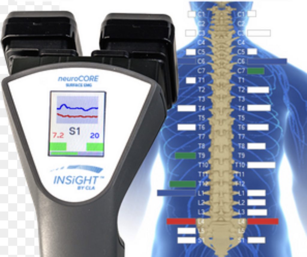 Insight™ Precision Imaging Technology Performance Chiropractic Clinic